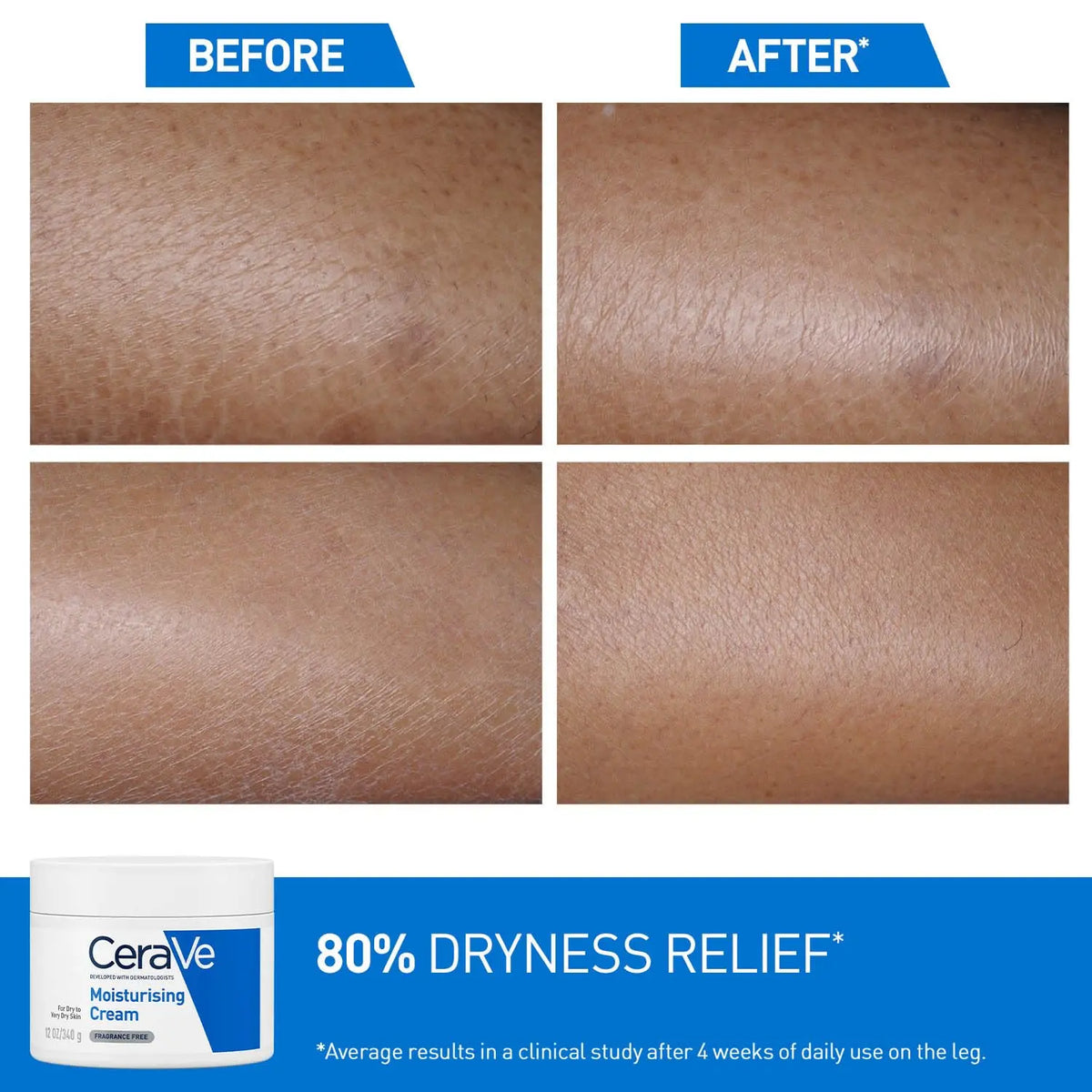 CeraVe Moisturizing Cream For Dry To Very Dry Skin (340gm) Product vendor