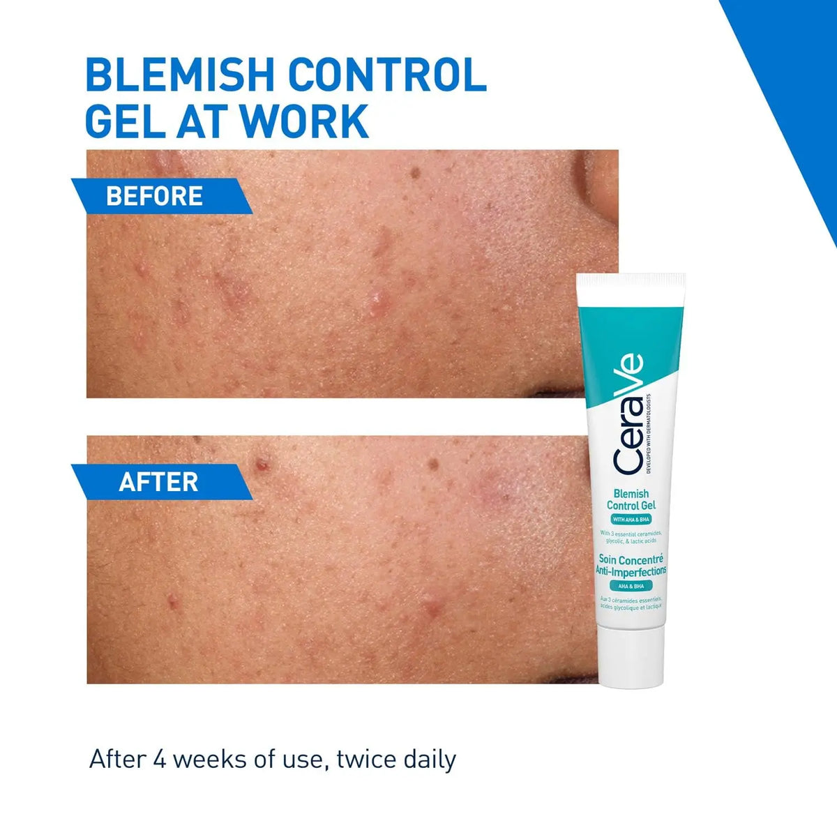 Cerave Blemish Control Gel (40ml) Product vendor